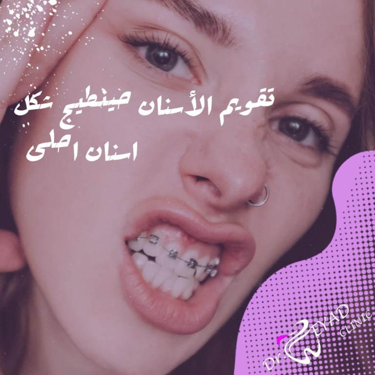 تقويم الاسنان 768x768