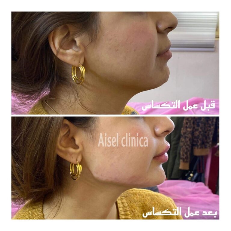 JPG عمل التكساس 768x768