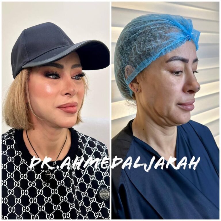 jpg قص الذقن 768x768