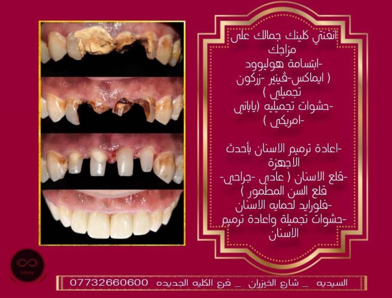 ابتسامه 1 768x585