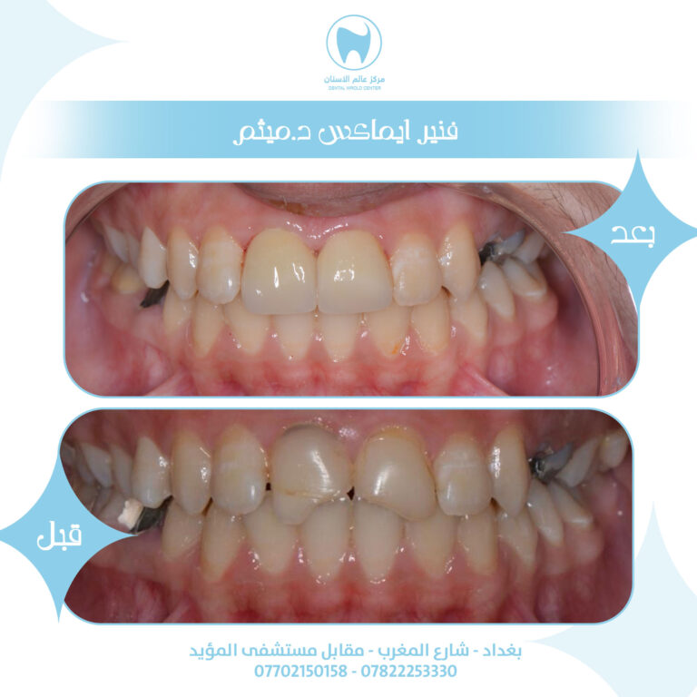 ابتسامه 5 768x768