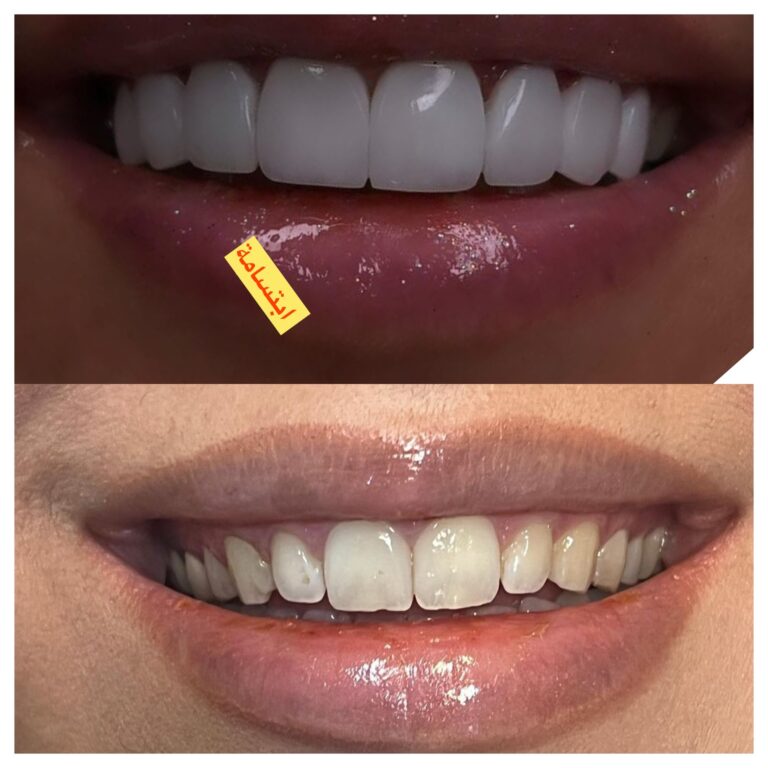 ابتسامه 6 768x768