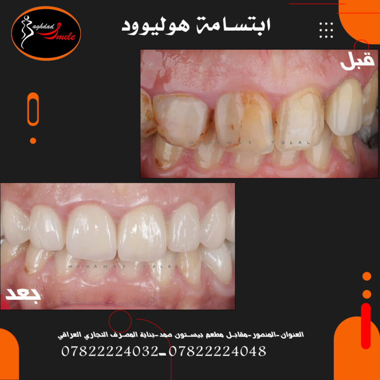 ابتسامه بغداد 768x768