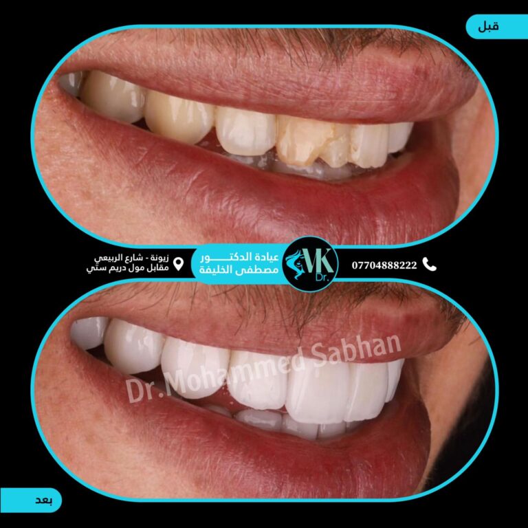 ابتسامه جميله 1 768x768