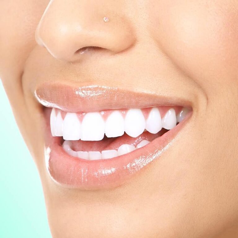 ابتسامه جميله 768x768