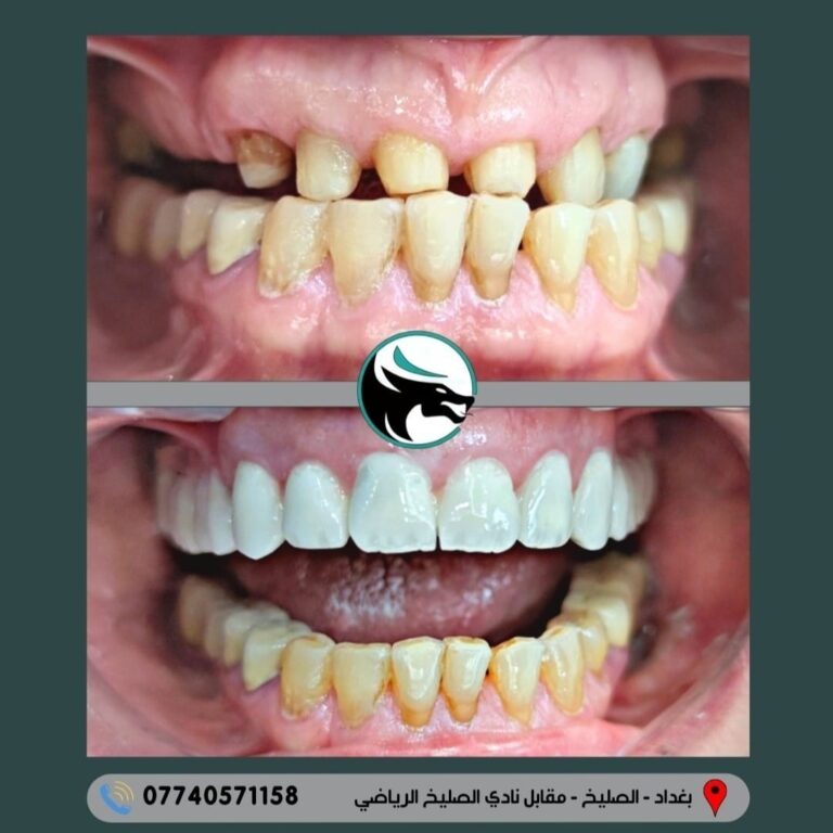 ابتسامه صحيه 768x768