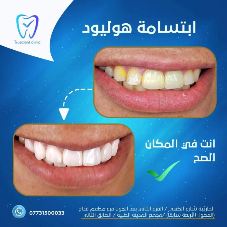 ابتسامه هوليهود 768x768