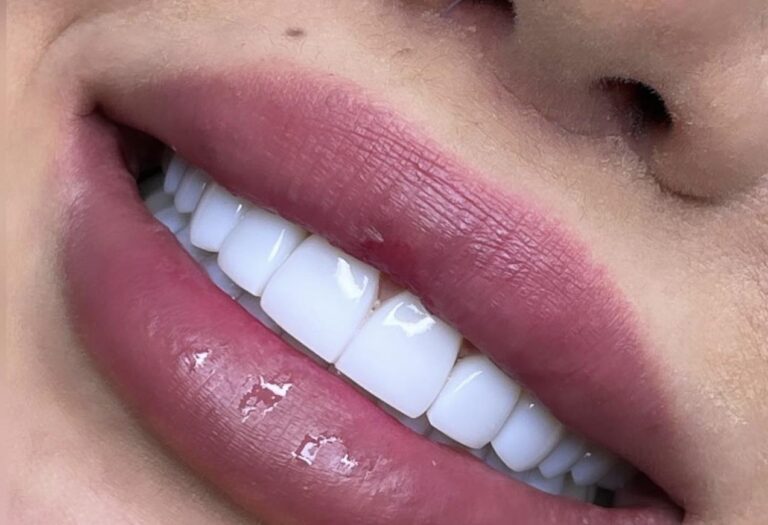 ابتسامه هوليود 3 768x525