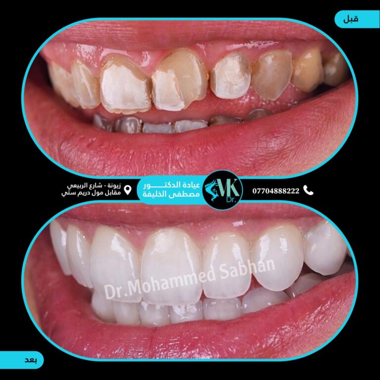 ابتستمه 768x768