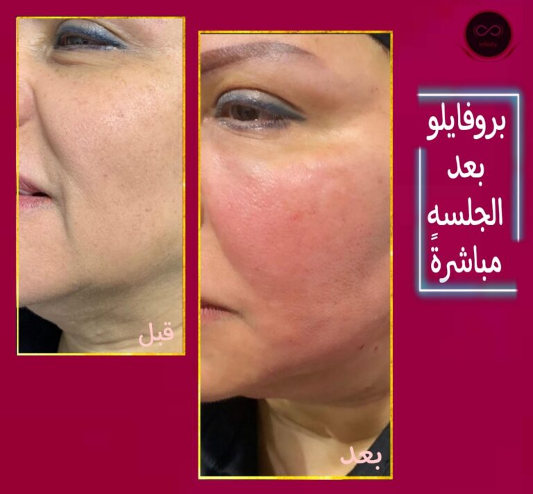 ابر الشد والنضاره 768x711