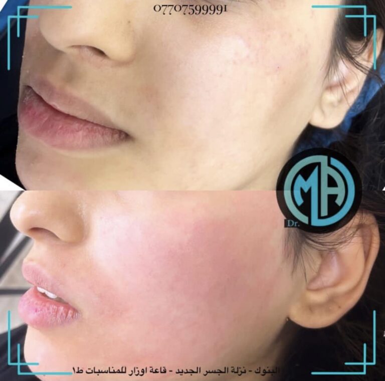 ابره نضاره 768x760