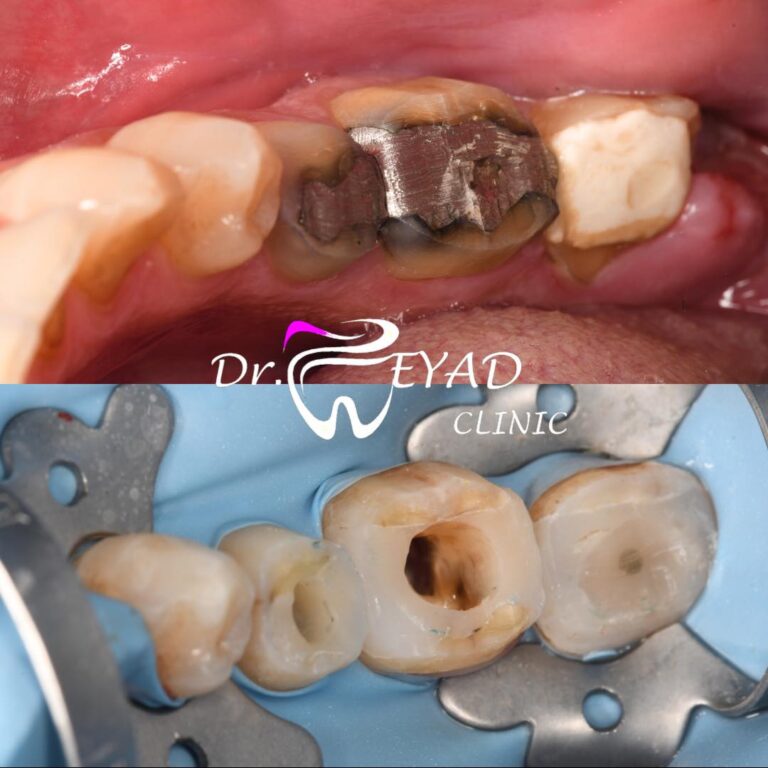 اثناء الزراعه 768x768