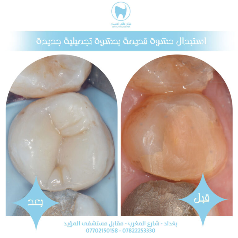 استبدال 768x768