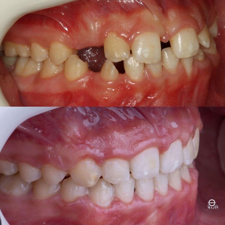 اسنان 4 768x768