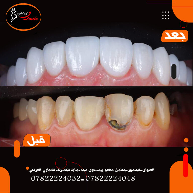 اعاده الابتسامه 768x768