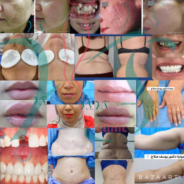 اغلب العمليات 768x768