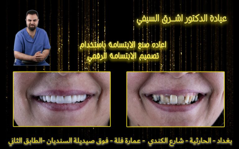 الابتسامه الرقميه 768x480