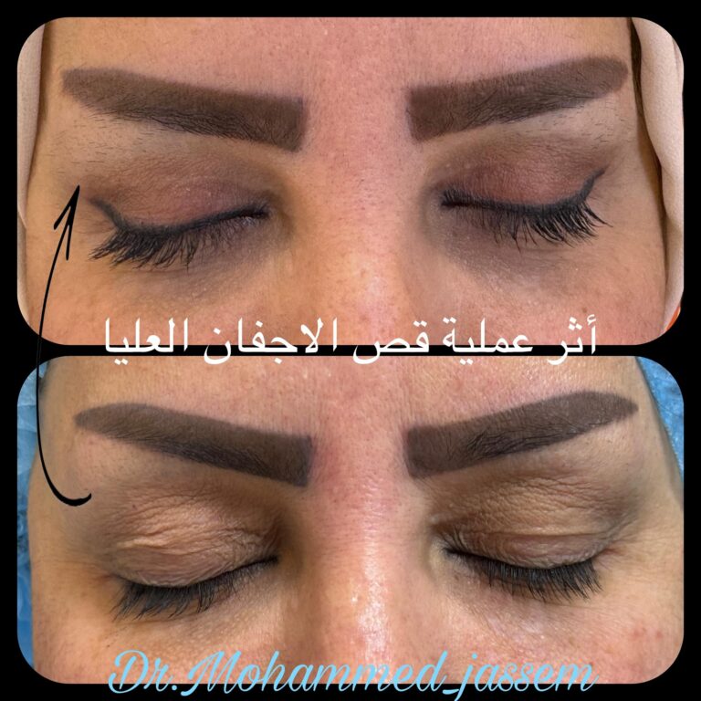 الاجفان 768x768