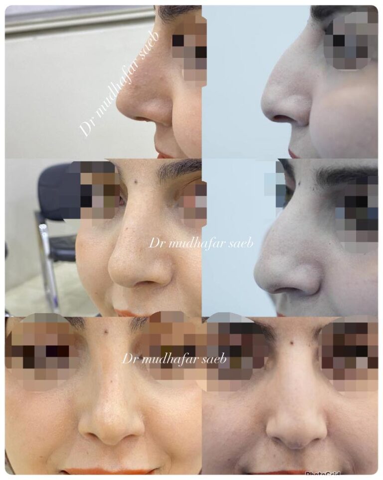 الانف من الامام 768x961