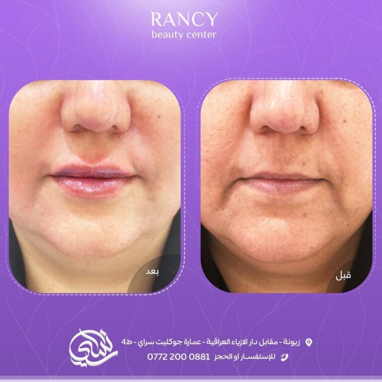 الخطوط الضاحكه 1 768x768