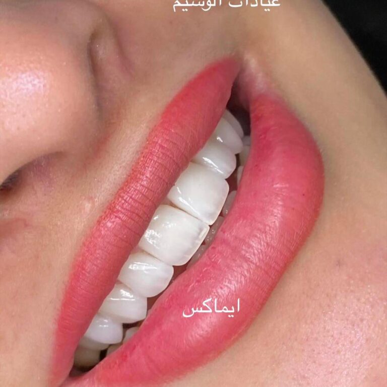 الوسيم 768x768