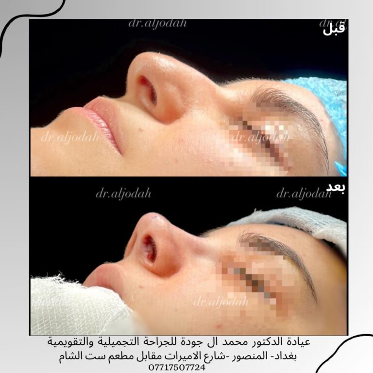 انحراف 1 768x768