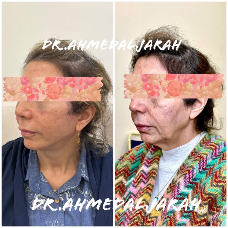 بعد ثلاث اشهر 768x768