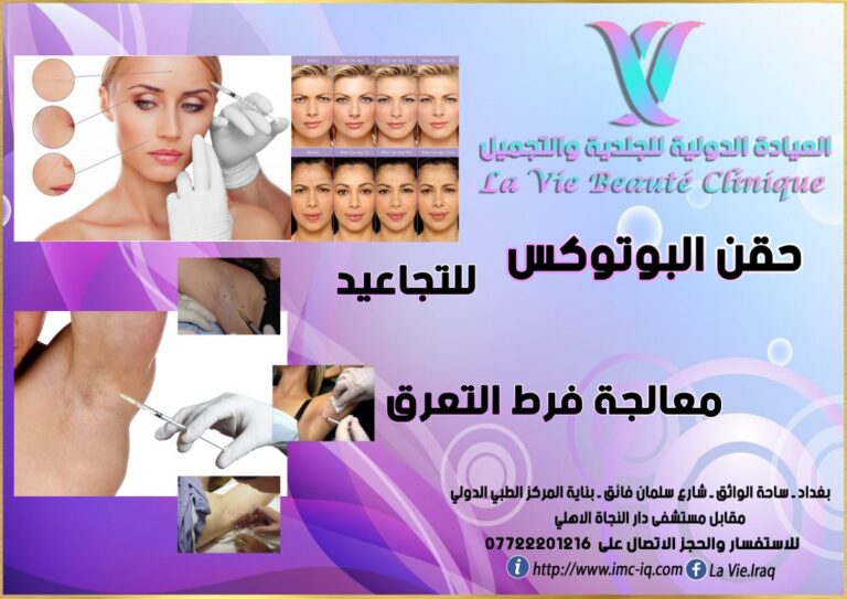 بوتوكس تجاعيد 768x543