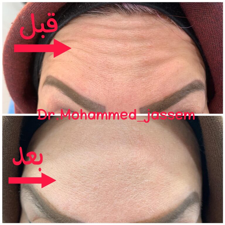 بونوكس 768x768