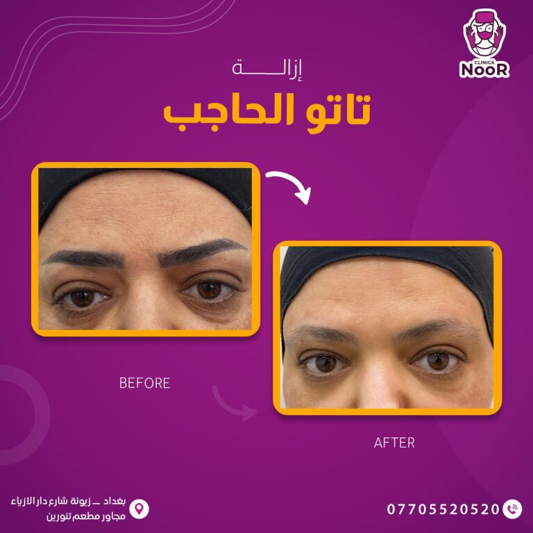 تاتو الحاجب 768x768