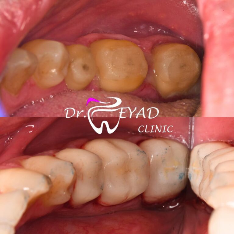 تجميل 1 768x768