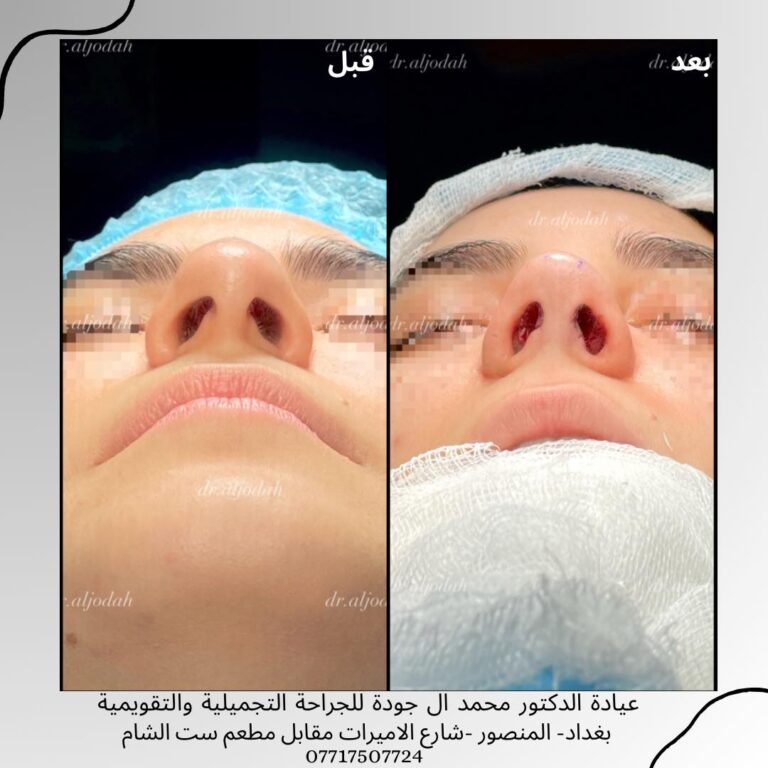 تجميل 4 768x768