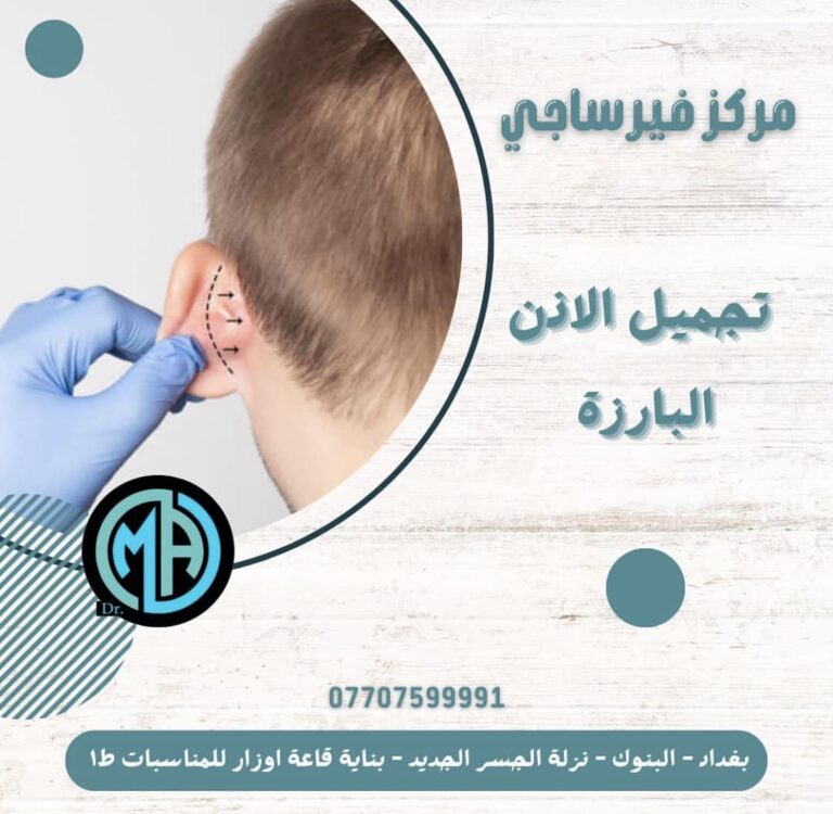 تجميل الاذن البارزه 768x750