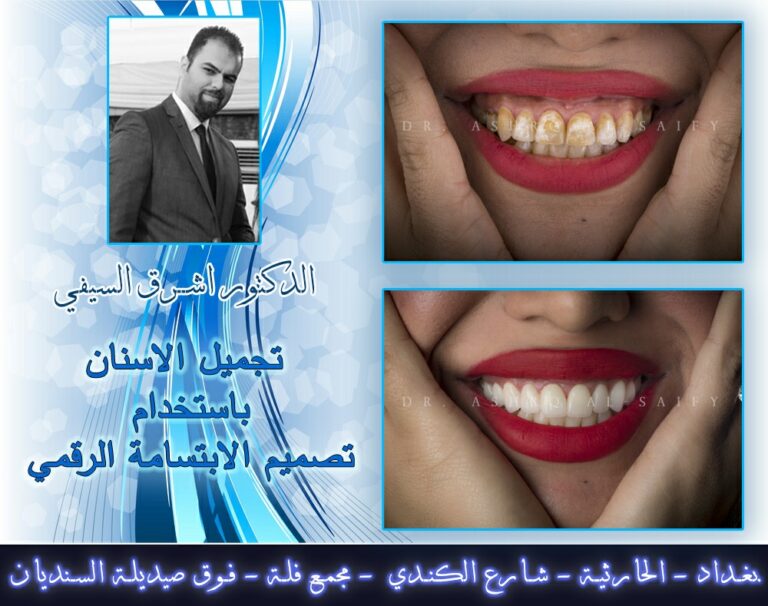 تجميل الاسنان 768x606