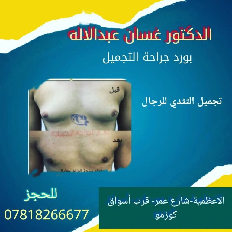 تجميل الثدي للرجال 768x768