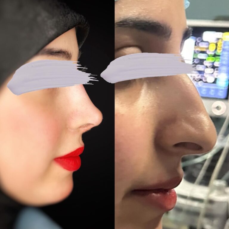 تجميل الوجه 768x768