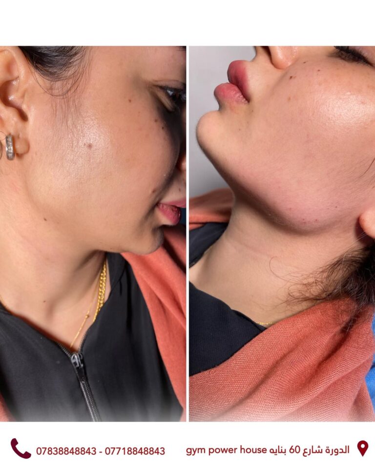 تحديد الفك 768x960