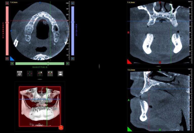 تصوير قبل الزراعة 1 768x528