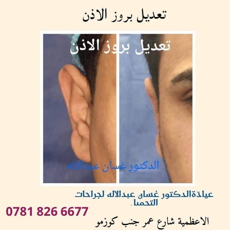 تعديل بروز الاذن 768x768