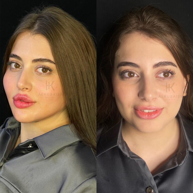 تغير شامل 2 768x768