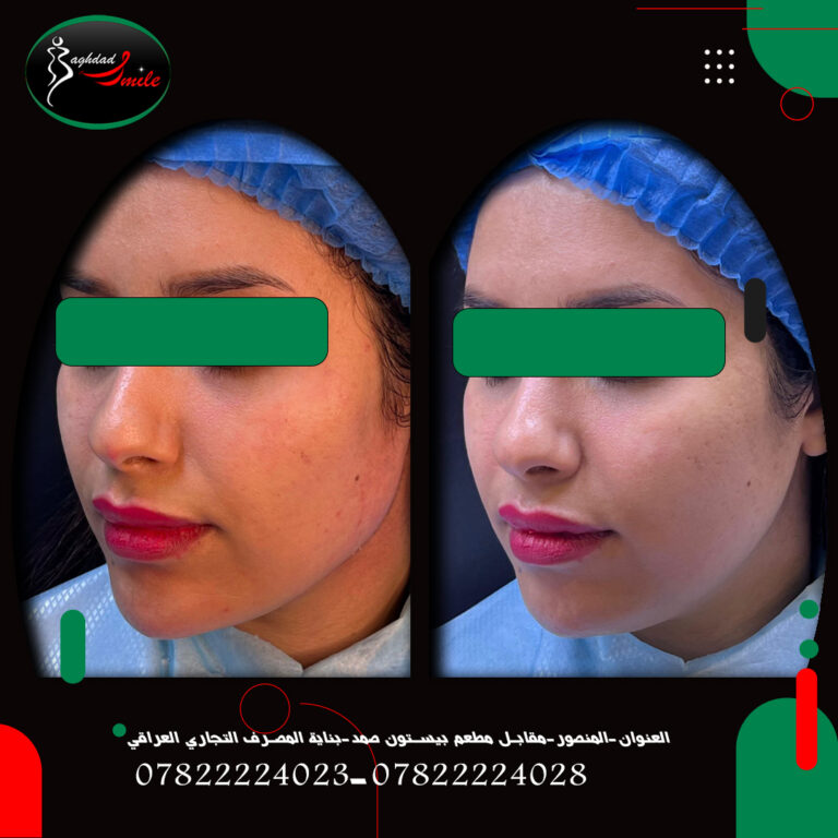 تغير شامل 768x768