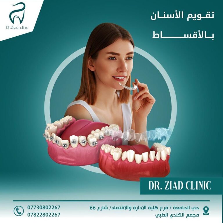 تقويم الاسنان 1 768x768