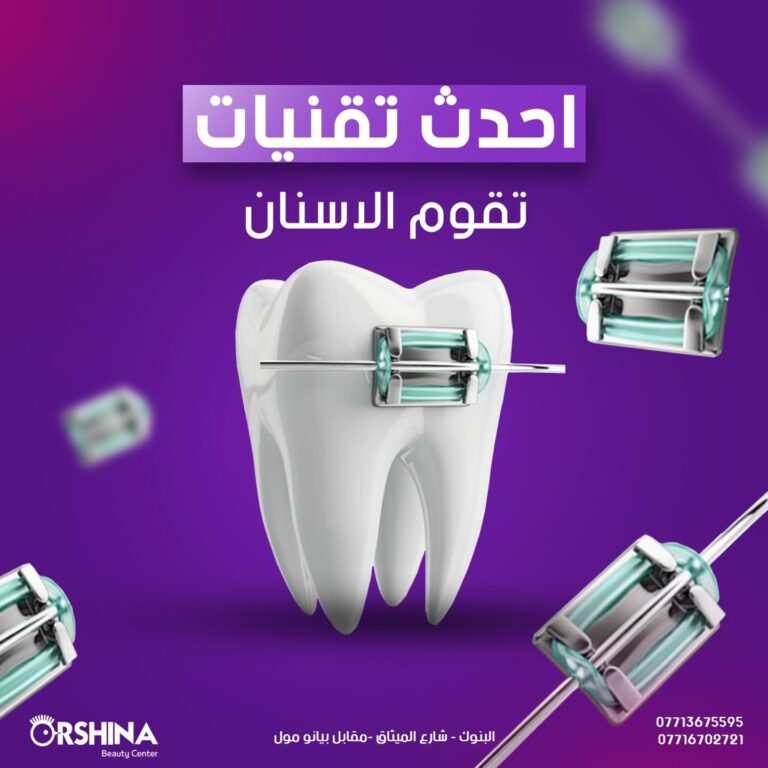 تقويم الاسنان 768x768