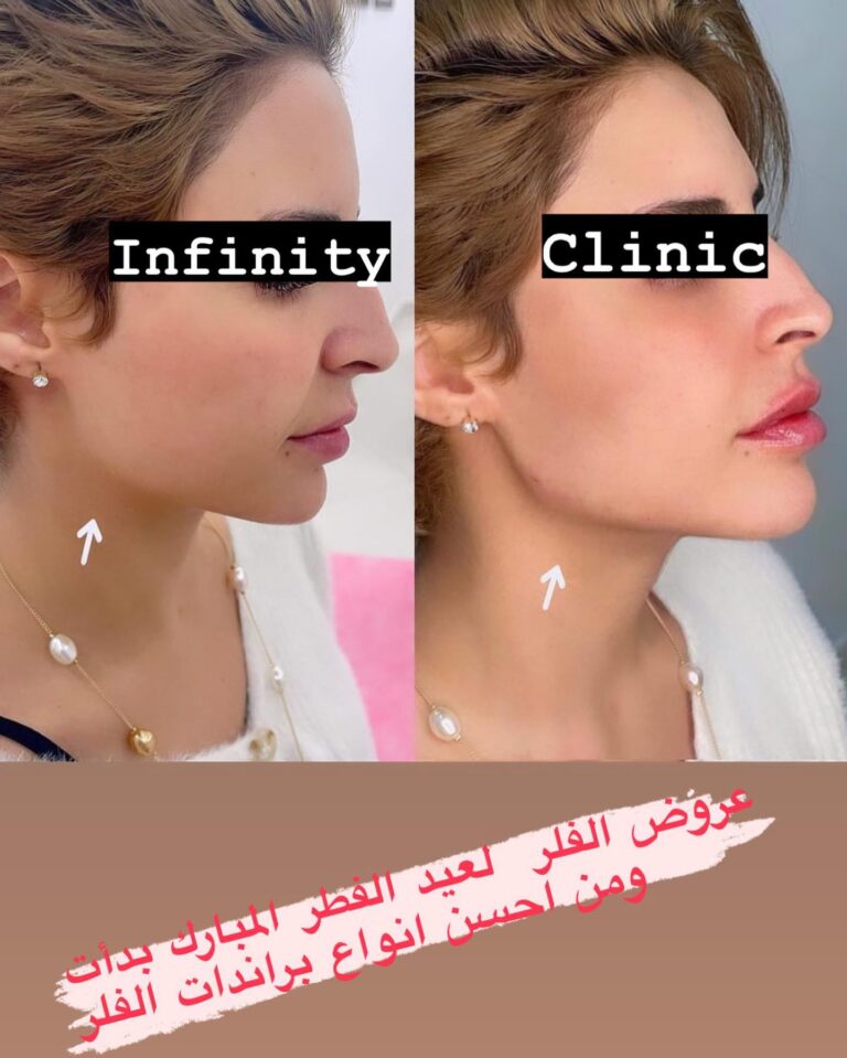 تكساس 1 768x959