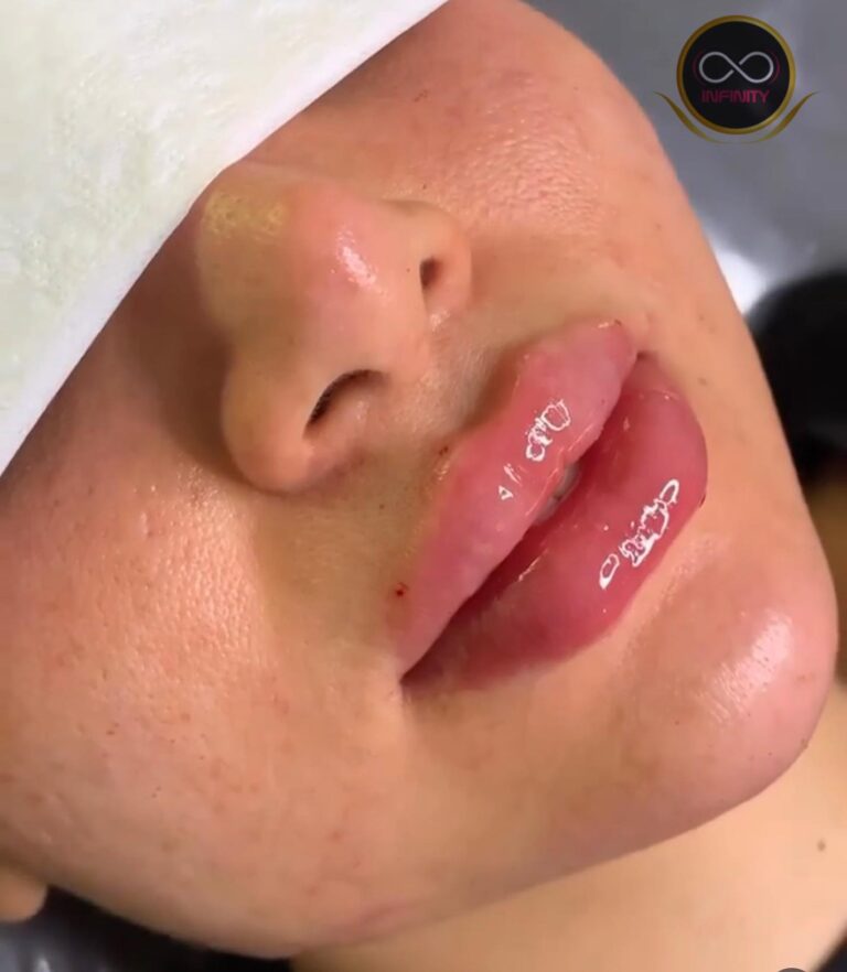 تنضيف بشره 768x882