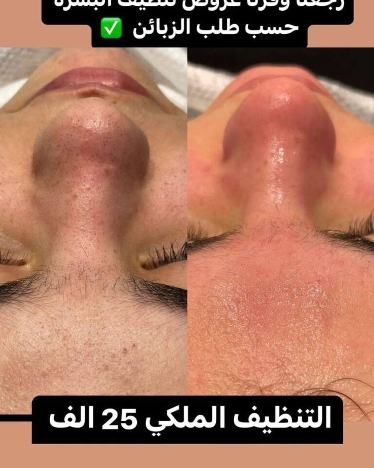 تنضيف ملكي 768x960