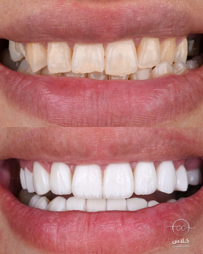 تنظيف 2 768x960