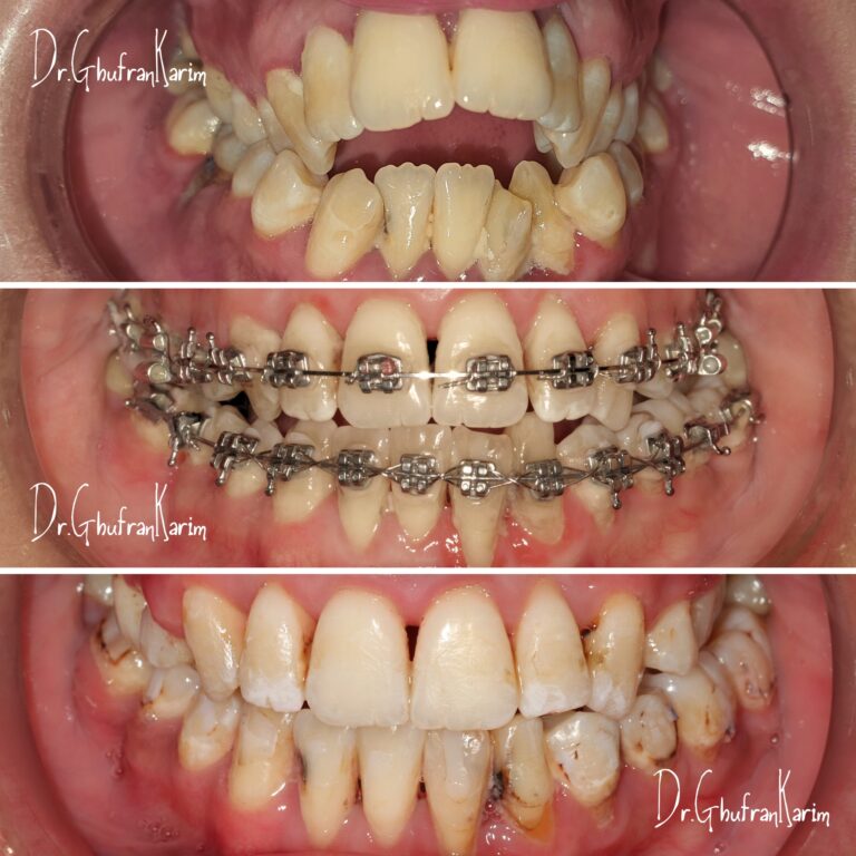 جسر تصحيح 768x768