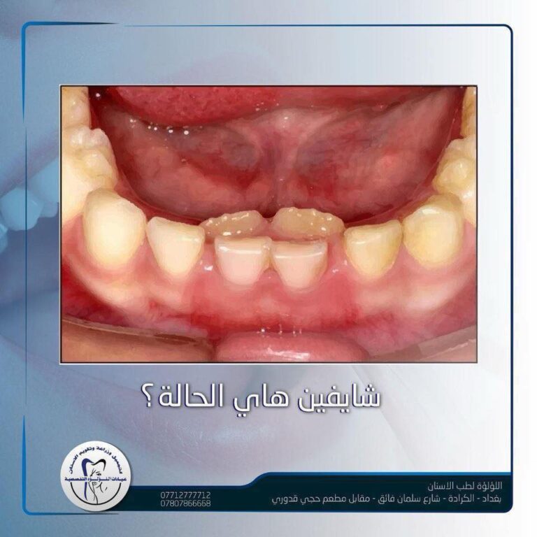 حاله غربيه 768x768