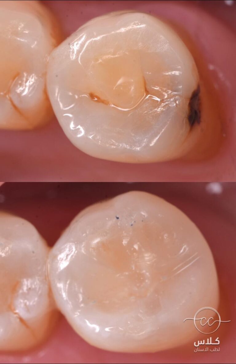 حشوات 2 768x1184